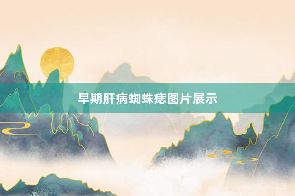 早期肝病蜘蛛痣图片展示